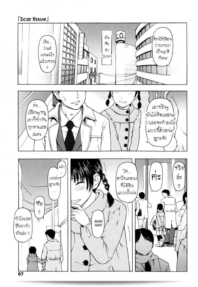 แผลฉิ่งในใจ [Onizuka Naoshi] Scar Tissue